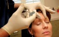 /album/fotografias-clinicas/img-15-jpg/
